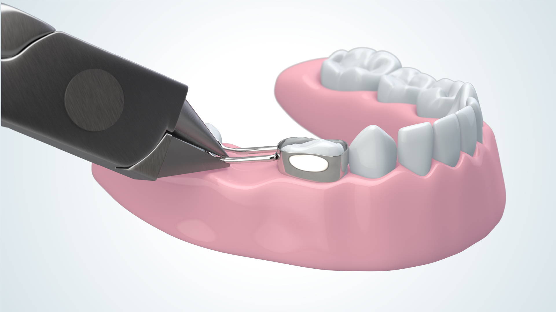 Denovo Dental 3D Animated Product Video